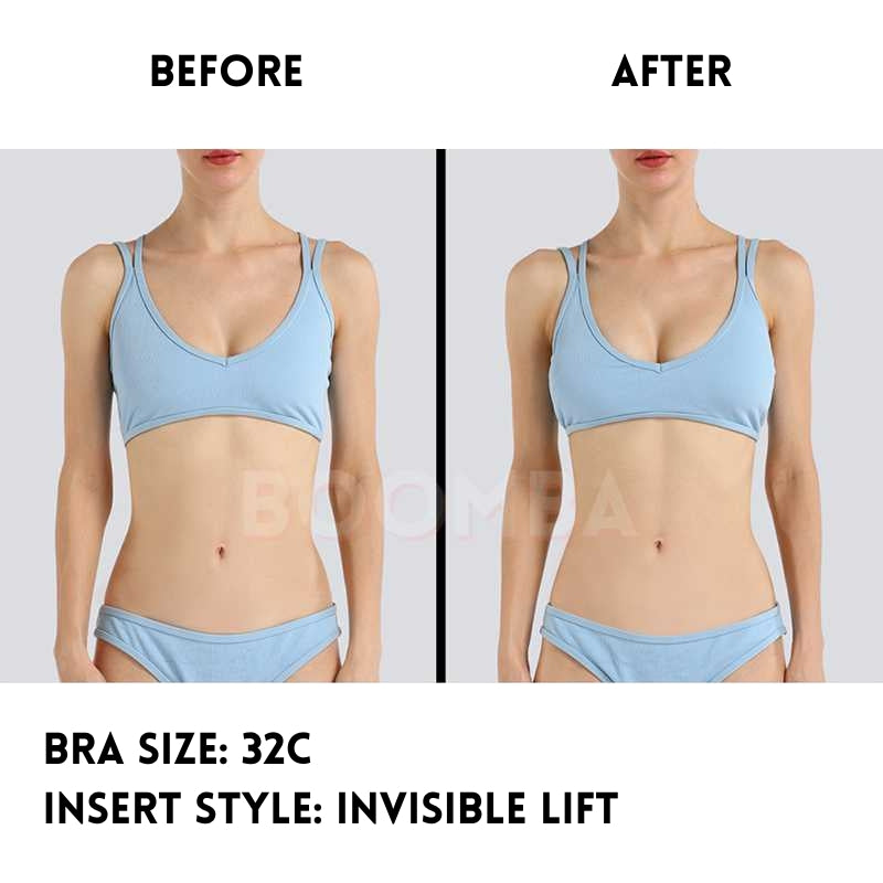 Invisible Lift Inserts